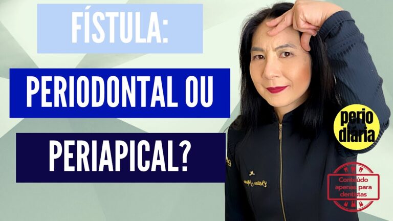 Tratamento Eficaz do CID Abscesso Dentário com Fístula