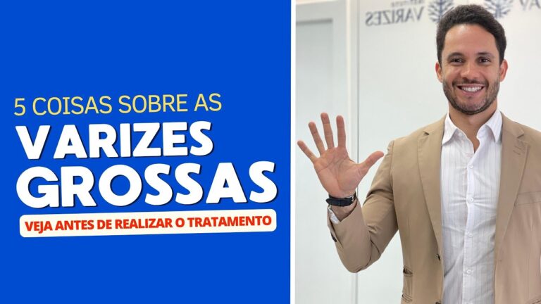 Veias Grossas nas Pernas: Causas e Soluções Eficazes