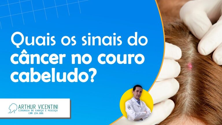 Tumores no Couro Cabeludo: Causas, Sintomas e Tratamentos