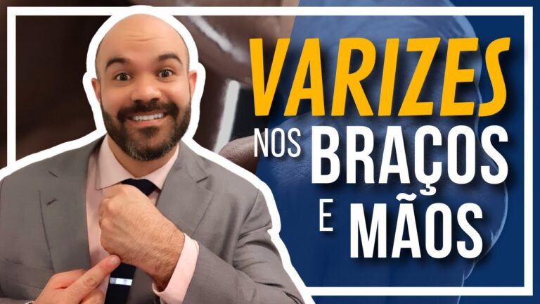 Entendendo as Varizes nos Braços: Causas e Tratamentos