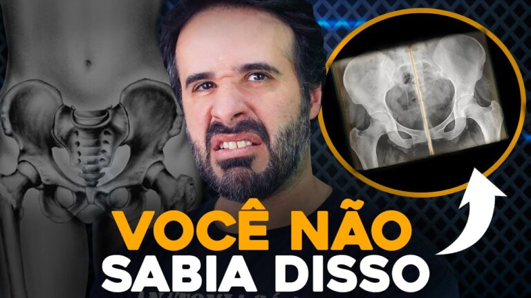 Entendendo a Fratura no Púbis: Causas e Tratamentos