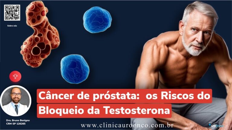 Inje&ccedil;&atilde;o na Barriga: Tratamento Inovador para C&acirc;ncer de Pr&oacute;stata