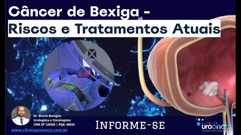Abordagem e Tratamento do Tumor de 5 cm na Bexiga