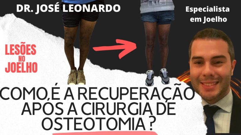 Osteotomia: Transformações Antes e Depois