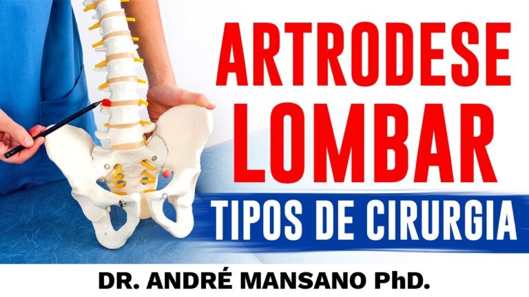Tipos de Cirurgia para Tratamento da Coluna Lombar