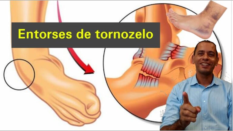 Como Tratar Tornozelo Inflamado de Forma Eficaz