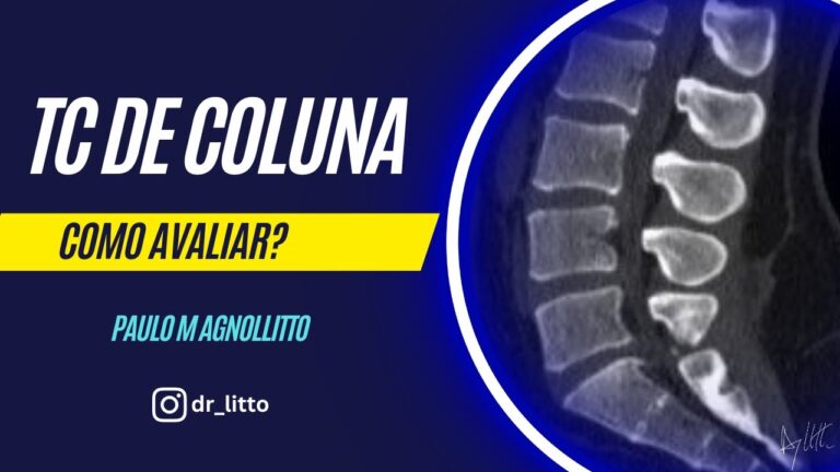 Tomografia Cervical Normal: Interpretação e Importância Clínica