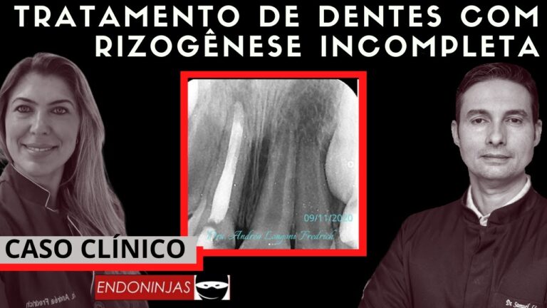 Entendendo o Apice do Dente: Importância e Cuidados