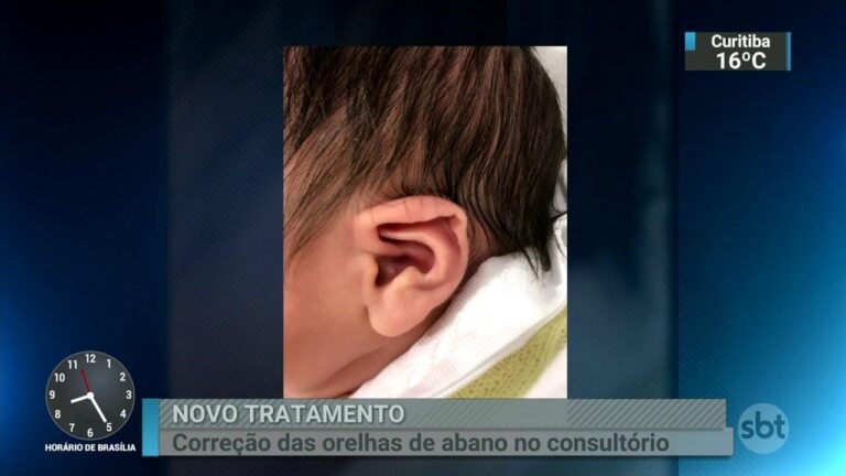 Métodos Naturais para Diminuir a Orelha de Abano