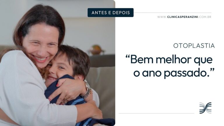 Transformação da Orelha de Abano: Resultados Antes e Depois