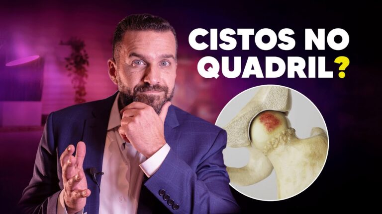Cisto no Fêmur: Causas, Sintomas e Tratamentos