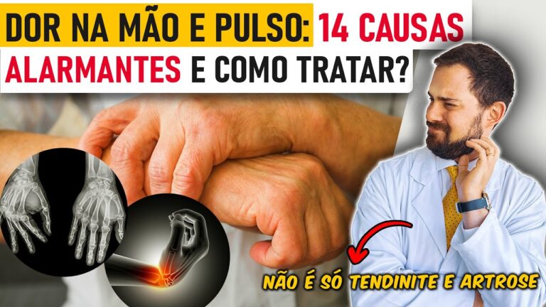 Entendendo as Doenças do Pulso: Causas e Tratamentos
