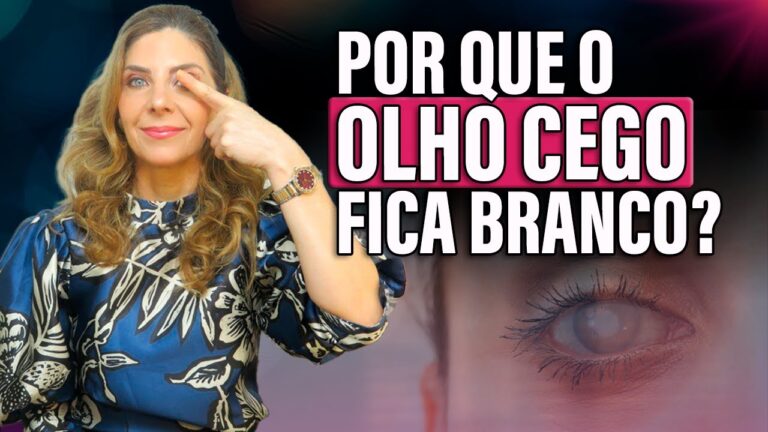 Olhos Brancos: Causas e Possíveis Significados
