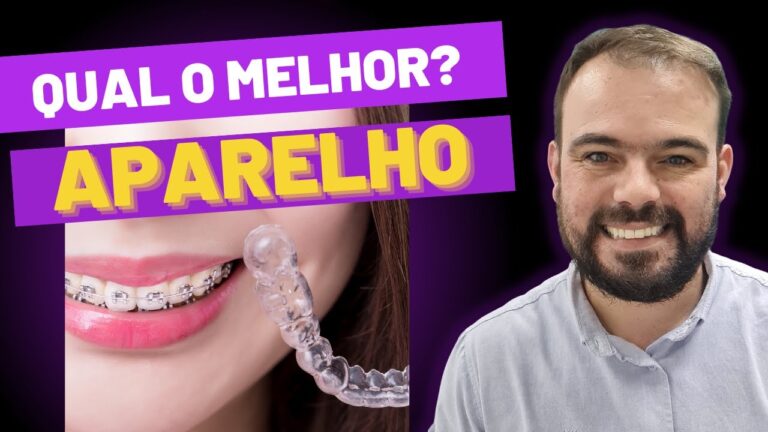 Aparelho Convencional Estético: Vantagens e Benefícios para o Sorriso