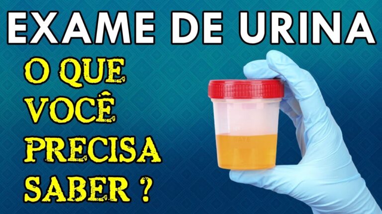 Exame de Urina: Doenças que Pode Detectar