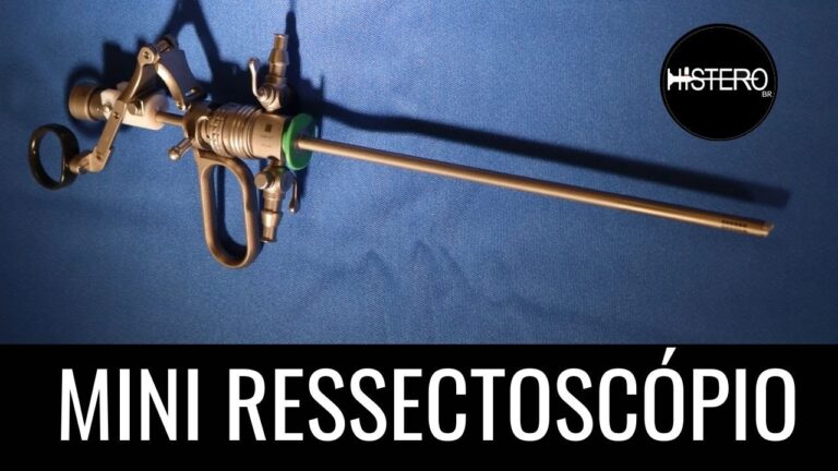 Histeroscopia com Ressectosc&oacute;pio: Avan&ccedil;os e Benef&iacute;cios na Sa&uacute;de Feminina