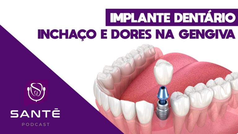 Inchaço Normal Após Implante Dentário: O Que Esperar