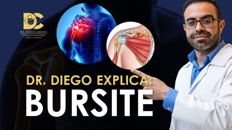 Causas da Bursite no Ombro: Entenda os Fatores Contribuintes