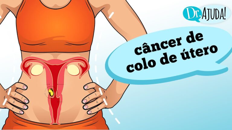 Compreendendo a Doença de Útero: Causas, Sintomas e Tratamentos