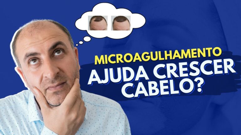 Microagulhamento Capilar: Eficácia Comprovada?