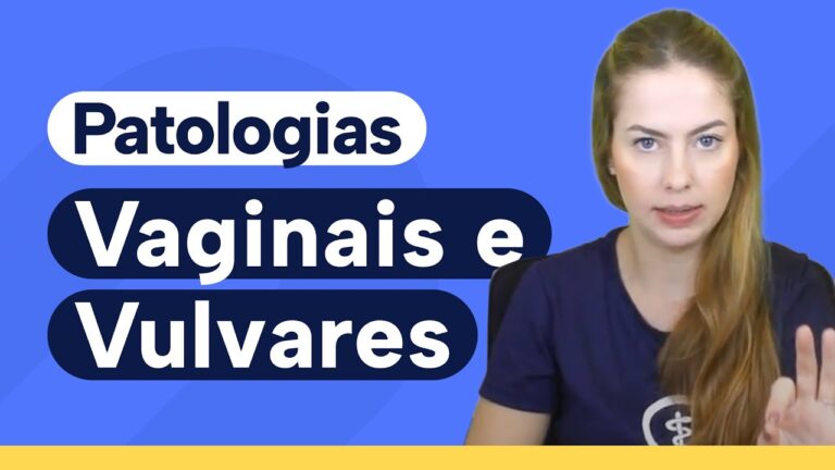 Saúde Íntima: Prevenção e Tratamento de Doenças na Buceta