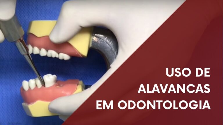 Alavancas na Odontologia: Indicações e Benefícios