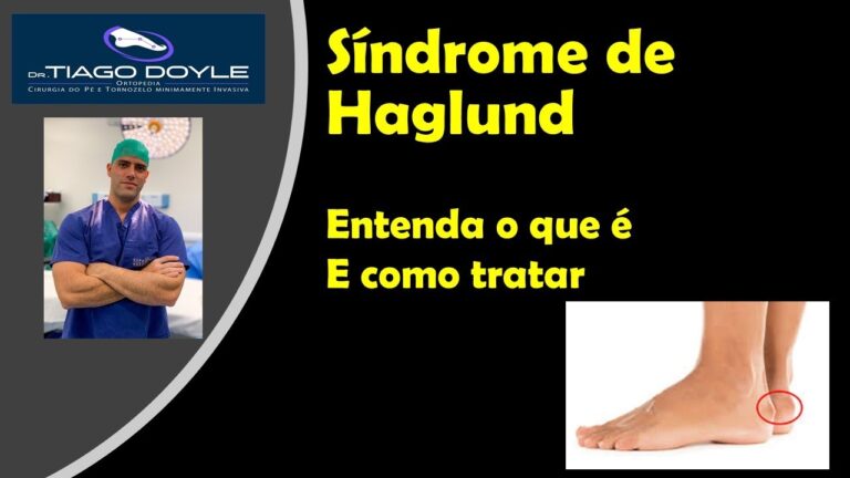 Síndrome de Haglund: Imagens e Diagnóstico
