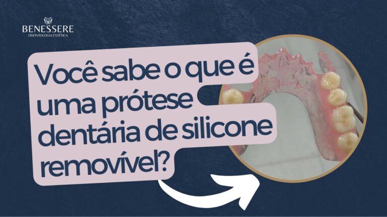 Vantagens da Prótese Dentária de Silicone
