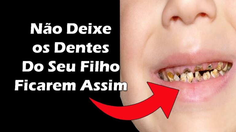Cuidado Dental para Crianças: Prevenindo Dentes Podres