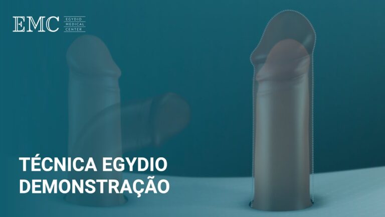 Correção da Curvatura Peniana: Opções e Resultados da Cirurgia