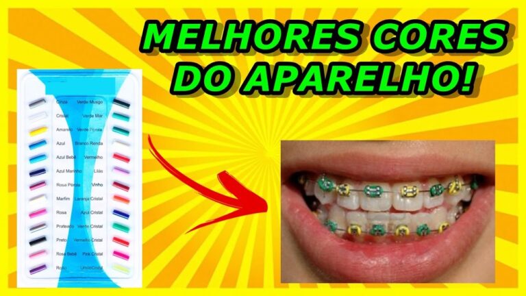 Cores de Aparelho Mais Populares