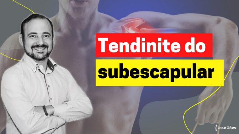 Tratamento Eficaz para Tendinopatia do Subescapular