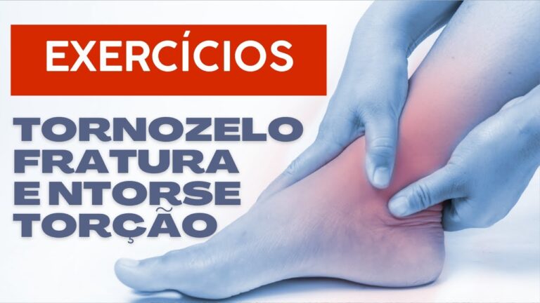 Fisioterapia Eficaz para Tornozelo Torcido