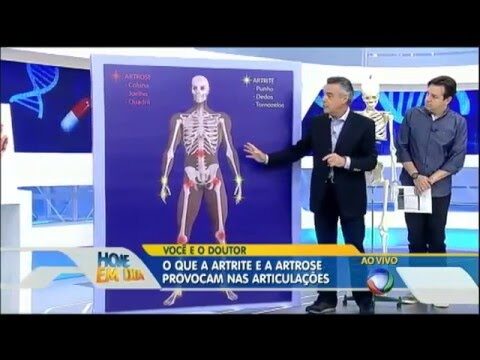 Artrite no Pé: Imagens e Informações Essenciais