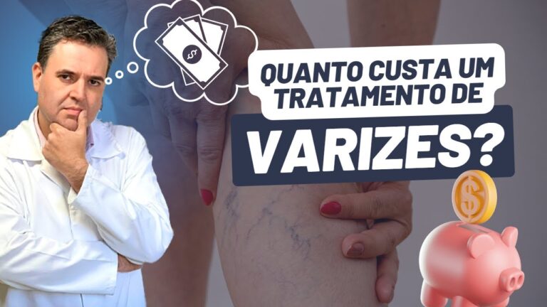 Preço de Tratamento para Secar Varizes