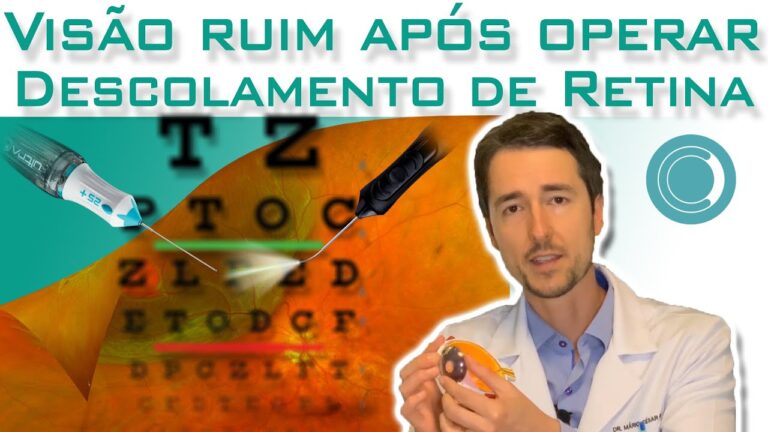 Visão Embaçada Após Cirurgia de Retina: Causas e Soluções