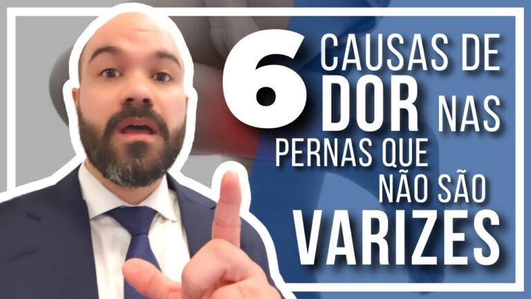 Varizes: Entenda a Causa da Dor nas Pernas