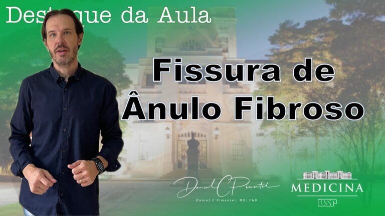 Fissura Radial: Causas, Sintomas e Tratamentos Eficazes
