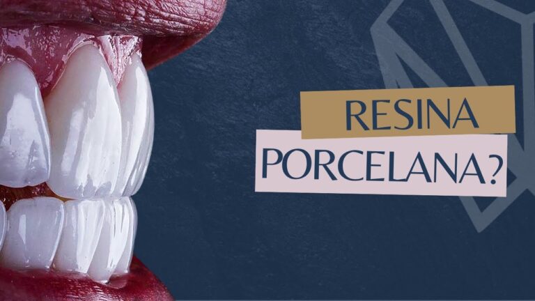 Resina ou Porcelana: Qual a Melhor Opção para os Dentes?