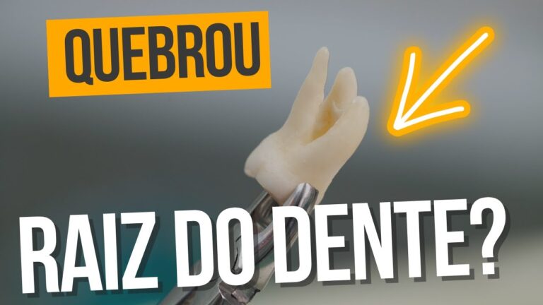 Dor na Raiz do Dente Quebrada: Causas e Soluções