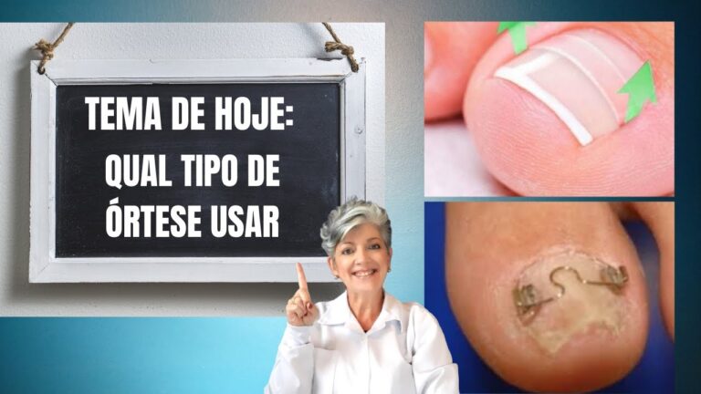 Tipos de Órteses em Podologia: Guia Completo