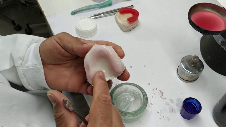 Benefícios da Prótese Acrílica Superior na Odontologia
