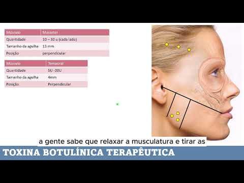 Benefícios do Botox Terapêutico na Saúde e Bem-Estar