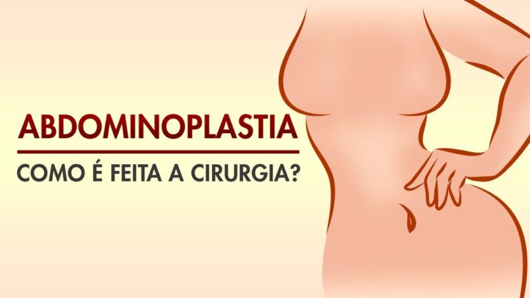 Entendendo a Cirurgia de Abdominoplastia: Processo e Técnicas