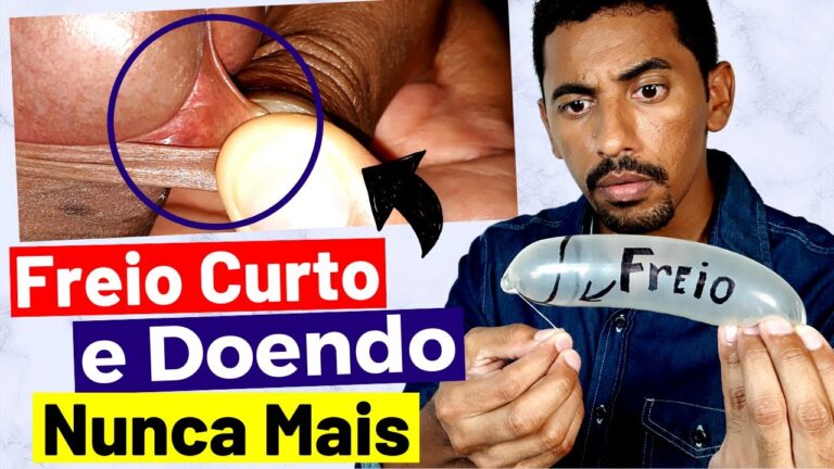 Penis Sem Freio: Entendendo os Riscos e Consequências