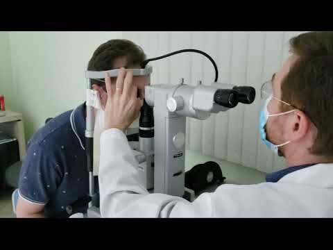 Iridectomia a Laser: Benefícios e Considerações