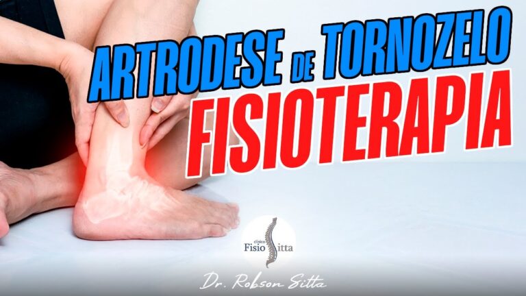 Recupera&ccedil;&atilde;o Eficiente Ap&oacute;s Artrodese de Tornozelo