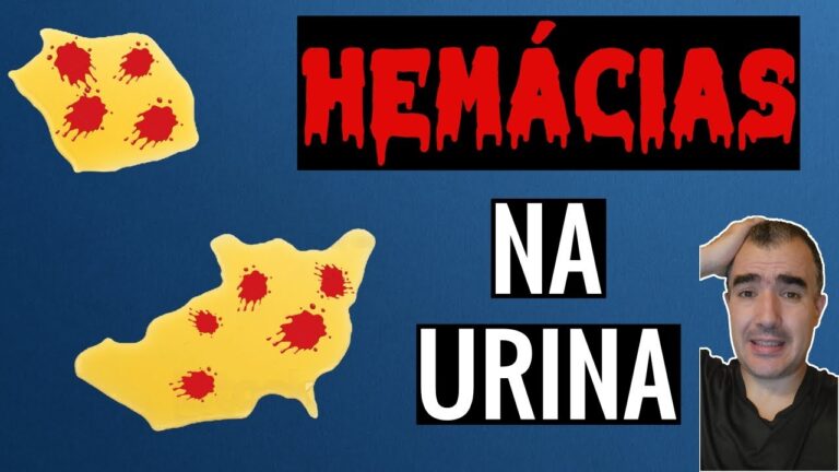 Significado das Hemácias no Exame de Urina