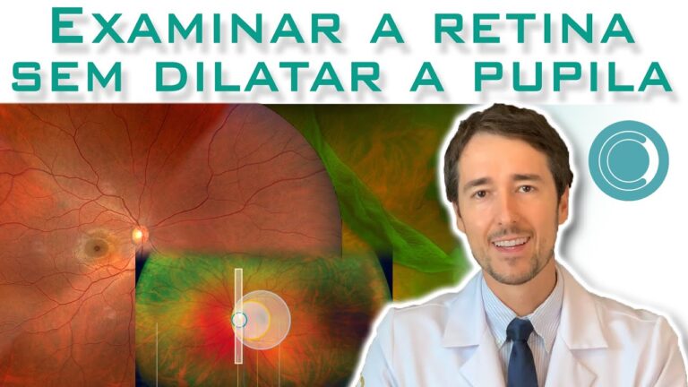 Dilatação da Pupila: Necessidade para Exame de Vista