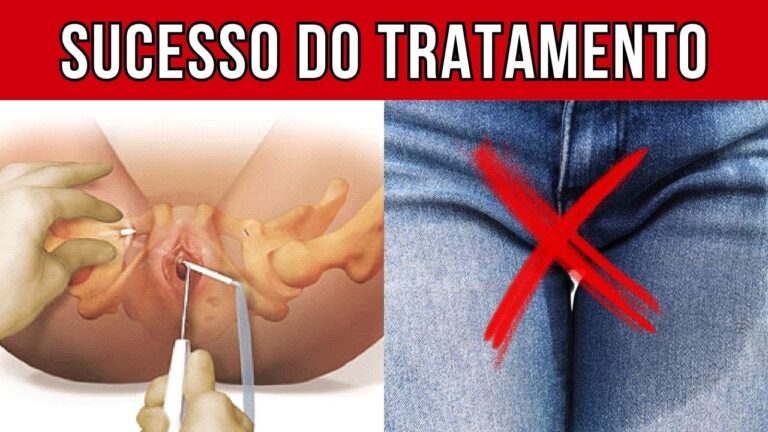 Cirurgia para Incontinência Urinária Feminina: Soluções Eficazes